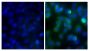 Human pancreatic carcinoma cell line MIA PaCa-2 was stained with Mouse Anti-Human CD44-BIOT (SB Cat. No. 9400-08; right) followed by Streptavidin-CY2 (SB Cat. No. 7100-21), DAPI, and mounted with Fluoromount-G<sup>&reg;</sup> Anti-Fade (SB Cat. No. 0100-35).
