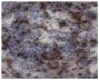 Frozen vIBDV infected bursal tissue section was stained with Mouse Anti-Chicken CD3-UNLB (SB Cat. No. 8200-01) followed by a secondary reagents and DAB.<br/>Image from Rauf A, Khatri M, Murgia MV, Jung K, Saif YM. Differential modulation of cytokine, chemokine and Toll like receptor expression in chickens infected with classical and variant infectious bursal disease virus. Vet Res. 2011;42:85. Figure 3[A(e)]<br/>Reproduced under the Creative Commons license https://creativecommons.org/licenses/by/2.0/
