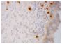 Frozen human endocervical section was stained with Goat Anti-Human IgD-BIOT (SB Cat. No. 2030-08) followed by a secondary antibody and DAB.<br/>Image from Hirbod T, Kaldensjö T, Broliden K. In situ distribution of HIV-binding CCR5 and C-type lectin receptors in the human endocervical mucosa. PLoS One. 2011;6(9):e25551. Figure 4(d)<br/>Reproduced under the Creative Commons Attribution License