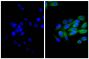 Human pancreatic carcinoma cell line MIA PaCa-2 was stained with Mouse Anti-Cytokeratin 18-UNLB (SB Cat. No. 10085-01; right) followed by Goat Anti-Mouse IgG(H+L), Multi-Species SP ads-BIOT (SB Cat. No. 1038-08), Streptavidin-FITC (SB Cat. No. 7100-02), and DAPI.