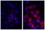 Human pancreatic carcinoma cell line MIA PaCa-2 was stained with Mouse IgG<sub>1</sub>-BIOT (SB Cat. No. 0102-08; left) and Mouse Anti-Fibrillin-1-BIOT (SB Cat. No. 1405-08; right) followed by Streptavidin-CY3.5 (SB Cat. No. 7100-24) and DAPI.