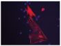 TGFB1 stimulated human dermal fibroblasts were stained with anti-ACTA2 followed by Goat Anti-Mouse IgG<sub>2a</sub>, Human ads-BIOT (SB Cat. No. 1080-08), CY3 conjugated Streptavidin, and DAPI.<br/>Image from Ploeger DT, Hosper NA, Schipper M, Koerts JA, de Rond S, Bank RA. Cell plasticity in wound healing: paracrine factors of M1/ M2 polarized macrophages influence the phenotypical state of dermal fibroblasts. Cell Commun Signal. 2013;11:29. Figure 5(b)<br/>Reproduced under the Creative Commons license https://creativecommons.org/licenses/by/2.0/