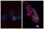 Human epithelial carcinoma cell line HEp-2 was stained with Mouse Anti-Cytokeratin 18-UNLB (SB Cat. No. 10085-01; right) and Mouse Anti-Human CD44-FITC (SB Cat. No. 9400-02) followed by Goat Anti-Mouse IgG<sub>2b</sub>, Human ads-AF555 (SB Cat. No. 1090-32) and DAPI.