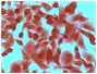 Human pancreatic carcinoma cell line MIA PaCa-2 was stained with Mouse Anti-Human CD44-UNLB (SB Cat. No. 9400-01; IgG<sub>2a</sub>) and Mouse Anti-Acetyl-Histone H3 (Lys4)-UNLB (SB Cat. No. 13600-01; IgG<sub>2b</sub>) followed by Goat Anti-Mouse IgG<sub>2a</sub>, Human ads-AP (SB Cat. No. 1080-04) and Goat Anti-Mouse IgG<sub>2b</sub>, Human ads-HRP (SB Cat. No. 1090-05), Red AP, DAB, and mounted with Fluoromount-G<sup>&reg;</sup> (SB Cat. No. 0100-01).