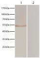 Lane 1 - pVAX-EF-1α transfected BHK cells<br/>Lane 2 - pVAXI transfected BHK cells<br/>pVAX-EF-1α and pVAXI transfected BHK cells were resolved by electrophoresis, transferred to membrane, and probed with anti-T. gondii followed by Goat Anti-Chicken IgY(H+L)-HRP (SB Cat. No. 6100-05) and DAB.<br/>Image from Wang S, Wang Y, Sun X, Zhang Z, Liu T, Gadahi JA, et al. Protective immunity against acute toxoplasmosis in BALB/c mice induced by a DNA vaccine encoding <i>Toxoplasma gondii</i> elongation factor 1-alpha. BMC Infect Dis. 2015;15:448. Figure 3<br/>Reproduced under the Creative Commons license https://creativecommons.org/licenses/by/4.0/