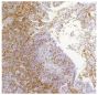 Paraffin embedded low pathogenic avian influenza virus infected lung section was stained with Mouse Anti-Chicken CD8α-UNLB (SB Cat. No. 8220-01) followed by a secondary antibody, DAB, and haematoxylin.<br/>Image from Rebel JM, Peeters B, Fijten H, Post J, Cornelissen J, Vervelde L. Highly pathogenic or low pathogenic avian influenza virus subtype H7N1 infection in chicken lungs: small differences in general acute responses. Vet Res. 2011;42:10. Figure 4(a)<br/>Reproduced under the Creative Commons license https://creativecommons.org/licenses/by/2.0/