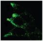MYH1 siRNA transfected MCF7 cells were stained with Mouse Anti-Human CD107b-UNLB (SB Cat. No. 9840-01) followed by a secondary antibody.<br/>Image from Groth-Pedersen L, Aits S, Corcelle-Termeau E, Petersen NH, Nylandsted J, Jäättelä M. Identification of cytoskeleton- associated proteins essential for lysosomal stability and survival of human cancer cells. PLoS One. 2012;7:e45381. Figure 2(c)<br/>Reproduced under the Creative Commons license https://creativecommons.org/licenses/by/4.0/
