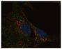 RA differentiated SH-SY5Y neuroblastoma cells were stained with Mouse Anti-Human CD107b-UNLB (SB Cat. No. 9840-01) and anti-Aβ40 followed by AF546 and AF488 conjugated secondary antibodies and DAPI.<br/>Image from Zheng L, Cedazo-Minguez A, Hallbeck M, Jerhammar F, Marcusson J, Terman A. Intracellular distribution of amyloid beta peptide and its relationship to the lysosomal system. Transl Neurodegener. 2012;1:19. Figure 3(c)<br/>Reproduced under the Creative Commons license https://creativecommons.org/licenses/by/2.0/