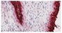Frozen human synovial tissue section from patient with osteoarthritis was stained with hematoxylin and eosin and Mouse Anti-Human CD55-UNLB (SB Cat. No. 9661-01) followed by a secondary antibody and colorimetric substrate.<br/>Image from Mucke J, Hoyer A, Brinks R, Bleck E, Pauly T, Schneider M, et al. Inhomogeneity of immune cell composition in the synovial sublining: linear mixed modelling indicates differences in distribution and spatial decline of CD68+ macrophages in osteoarthritis and rheumatoid arthritis. Arthritis Res Ther. 2016;18:170. Figure 1<br/>Reproduced under the Creative Commons license https://creativecommons.org/licenses/by/4.0/