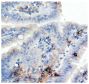 Paraffin embedded mouse lamina propria section post sensitization with shrimp tropomyosin was stained with anti-Stat3phosphoTyr705 followed by Goat Anti-Rabbit IgG(H+L), Mouse/Human ads-BIOT (SB Cat. No. 4050-08), HRP conjugated avidin, DAB, and hematoxylin.<br/>Image from Fu L, Peng J, Zhao S, Zhang Y, Su X, Wang Y. Lactic acid bacteria-specific induction of CD4<sup>+</sup>Foxp3<sup>+</sup>T cells ameliorates shrimp tropomyosin-induced allergic response in mice via suppression of mTOR signaling. Sci Rep. 2017;7:1987. Figure S8<br/>Reproduced under the Creative Commons license https://creativecommons.org/licenses/by/4.0/