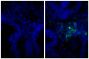 Paraffin embedded human gastric cancer tissue was stained with Rabbit IgG-UNLB isotype control (SB Cat. No. 0111-01; left) and Rabbit Anti-Human IgG(H+L), Mouse ads-UNLB (SB Cat. No. 6145-01; right) followed by Donkey Anti-Rabbit IgG(H+L), Mouse/Rat/Human SP ads-FITC (SB Cat. No. 6440-02) and DAPI.