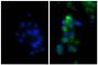 Human hepatocellular carcinoma cell line Hep G2 was stained with Rabbit IgG-UNLB isotype control (SB Cat. No. 0111-01; left) and Rabbit Anti-Human DR5-UNLB (SB Cat. No. 6600-01; right) followed by Donkey Anti-Rabbit IgG(H+L), Mouse/Rat/Human SP ads-FITC (SB Cat. No. 6440-02) and DAPI.
