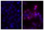 Human pancreatic carcinoma cell line MIA PaCa-2 was stained with Mouse Anti-Human CD44-BIOT (SB Cat. No. 9400-08; right) followed by Streptavidin-CY3 (SB Cat. No. 7100-12), DAPI, and mounted with Fluoromount-G<sup>&reg;</sup> Anti-Fade (SB Cat. No. 0100-35).