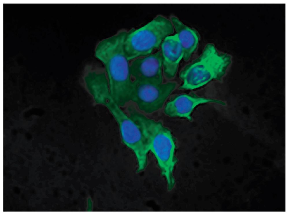 FITC Anti-Cytokeratin 8, SB37b | SouthernBiotech