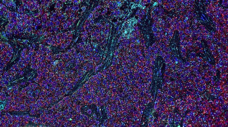 Introduction to Multiplex Immunoassays