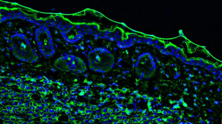 How to Reduce Autofluorescence