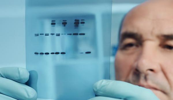 Introduction to Western Blot