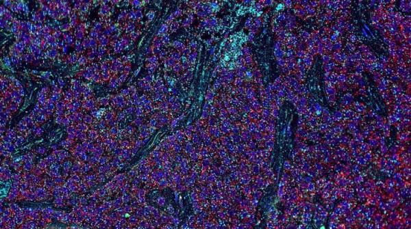 Introduction to Multiplex Immunoassays